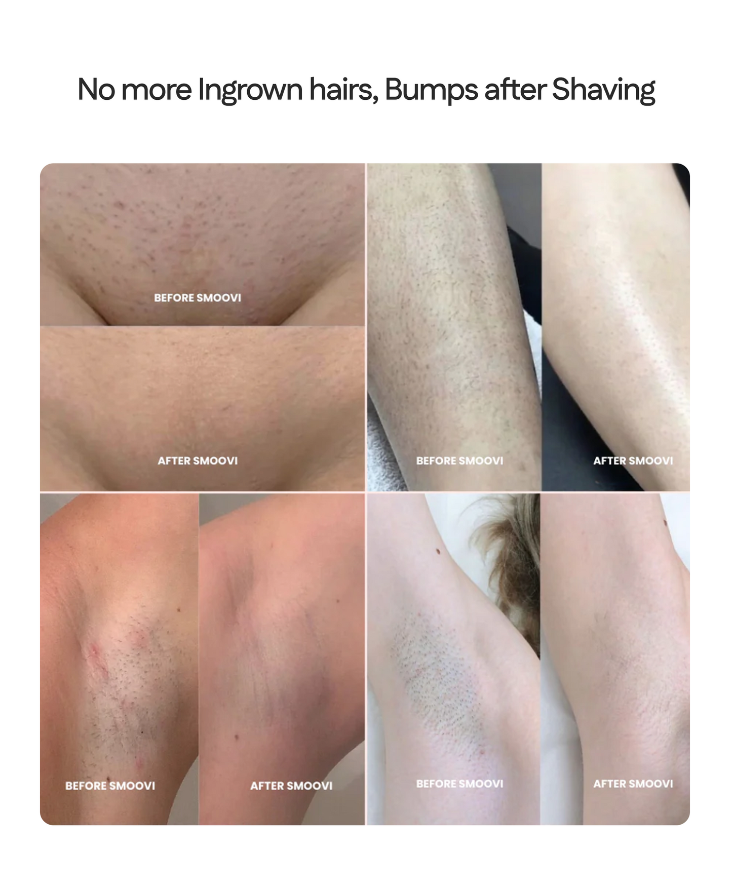 Maylara™ Bikini Shaver